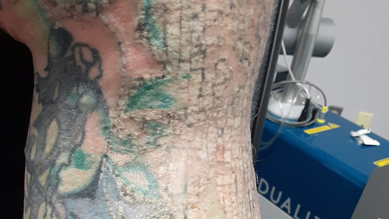 Visit a Local Shop That Offers Permanent Makeup Removal in Minneapolis, MN