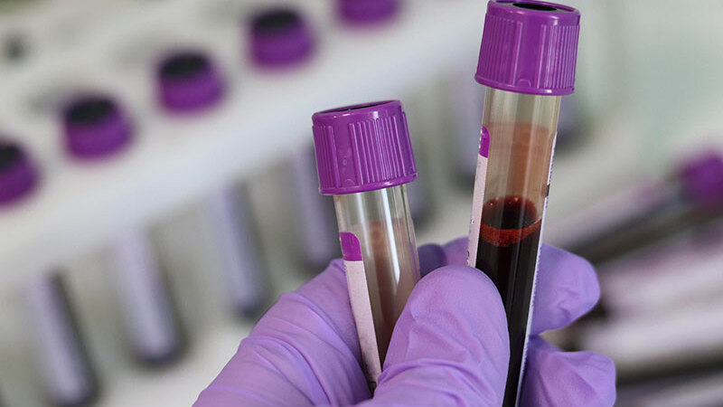 A Trusted Drug Screening Company is Ready to Assist You with a Dot Drug Screen Panel