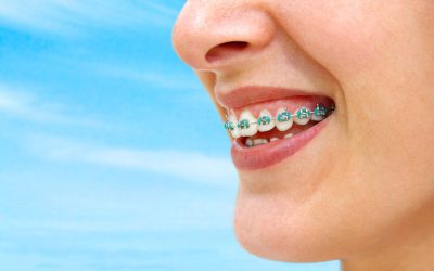 Tips You Should Consider When Looking for an Orthodontist in Strongsville, OH