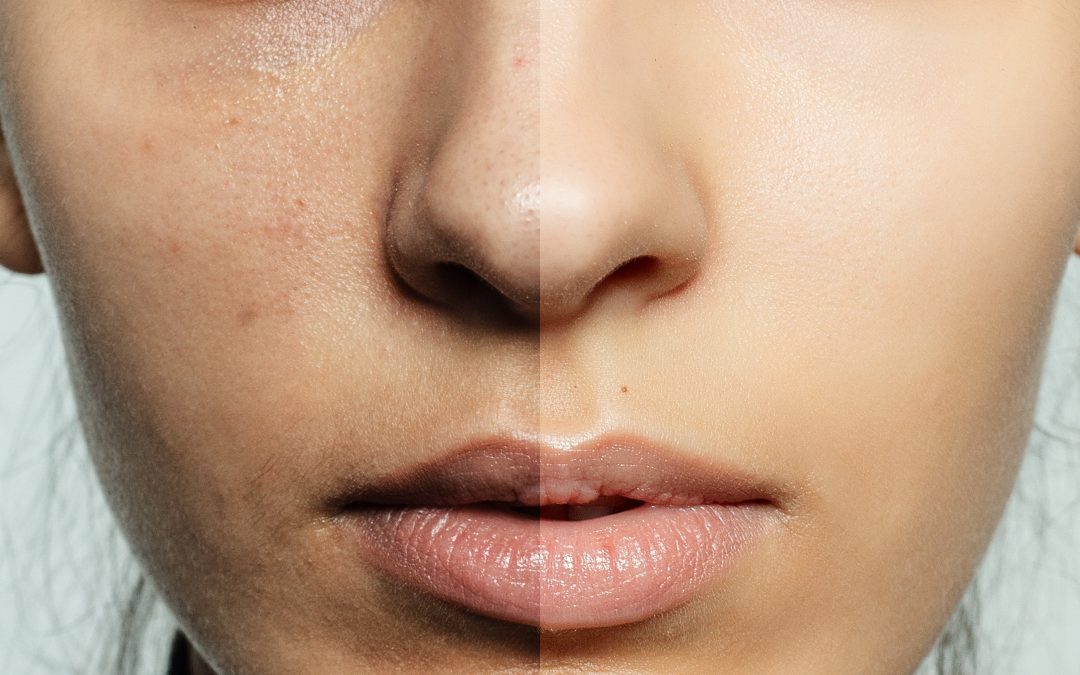 Preserve your youthful glow: Anti-aging skin care in Upper Falls MD