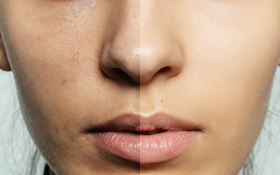 Preserve your youthful glow: Anti-aging skin care in Upper Falls MD