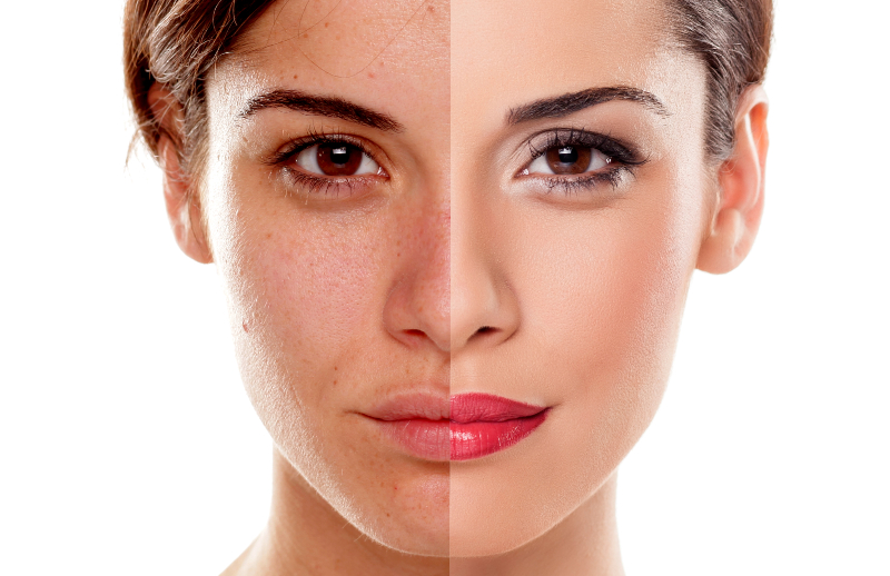 Look Younger and More Radiant with Skin Tightening Treatments at Luxe Beauty & Wellness on Tomball Pkwy
