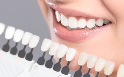 Unlock a Brighter Smile with Cosmetic Dentistry North Wilmington DE for Lasting Confidence